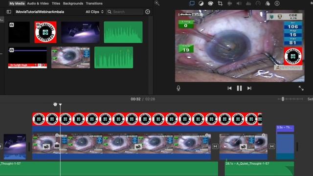 How To Use Freeze Frame In Apple Mac Video Editor  IMovie #Tutorial