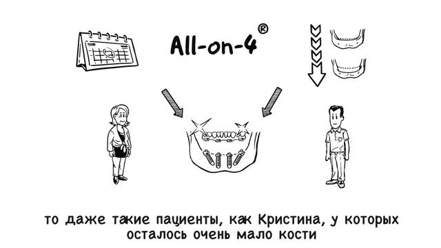 Протезирование ALL-on-4 наглядно смотреть онлайн