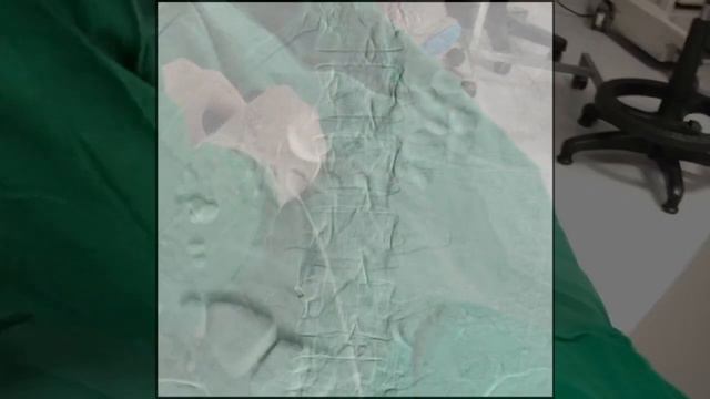 OPTEASE ® FILTER смотреть онлайн