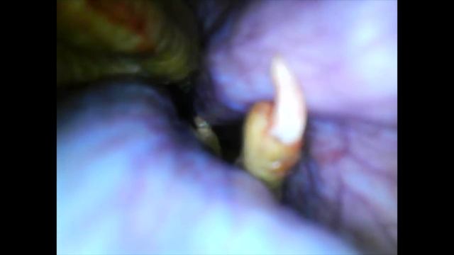 Anaconda Eats Valuable Show Chicken--Removed from Stomach Unharmed смотреть онлайн