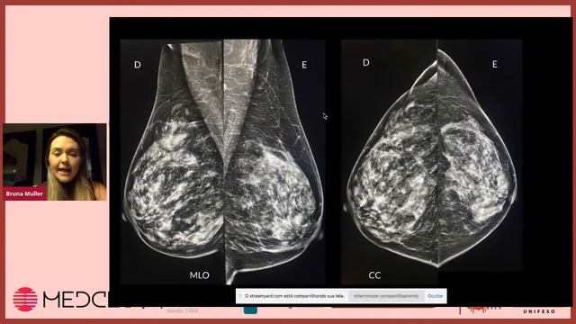 I CONGRESSO DE ONCOLOGIA DO UNIFESO - 8ª PALESTRA смотреть онлайн