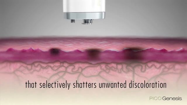 NEW Pico Genesis I Visage Laser Skin Care Anaheim I Celebrity Secrets of 2018 смотреть онлайн