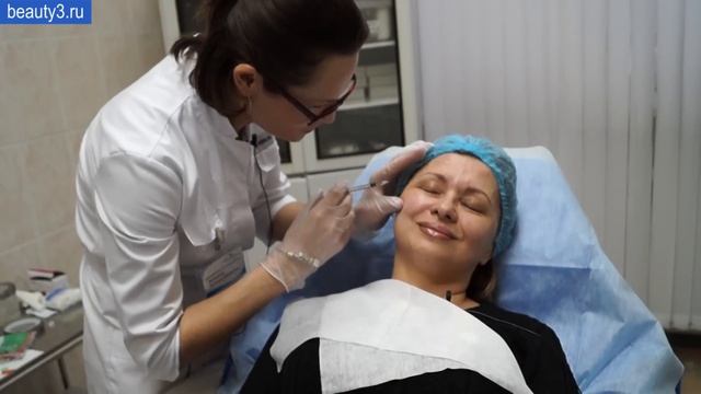 Инъекции диспорт в области межбровья, лба, вокруг глаз, верхней губы смотреть онлайн