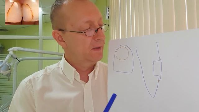 Что это за ...? смотреть онлайн