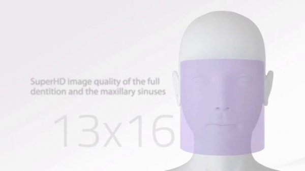 MyRay Hyperion X9 pro