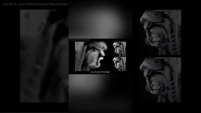 Управление языком #технологии #изобретения #новыетехнологии #гаджеты #интересно #интересное смотреть онлайн