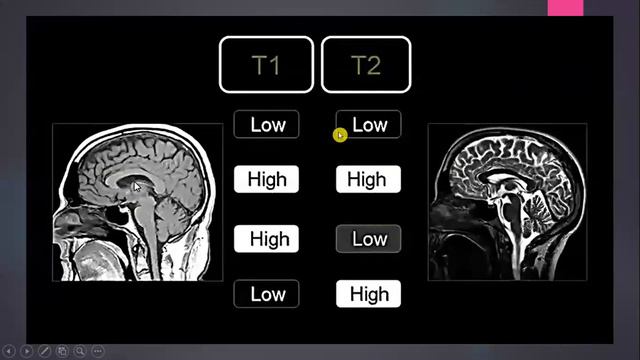 MRI смотреть онлайн