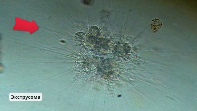 Наглядная микробиология #16 Солнечники (Heliozoa) смотреть онлайн