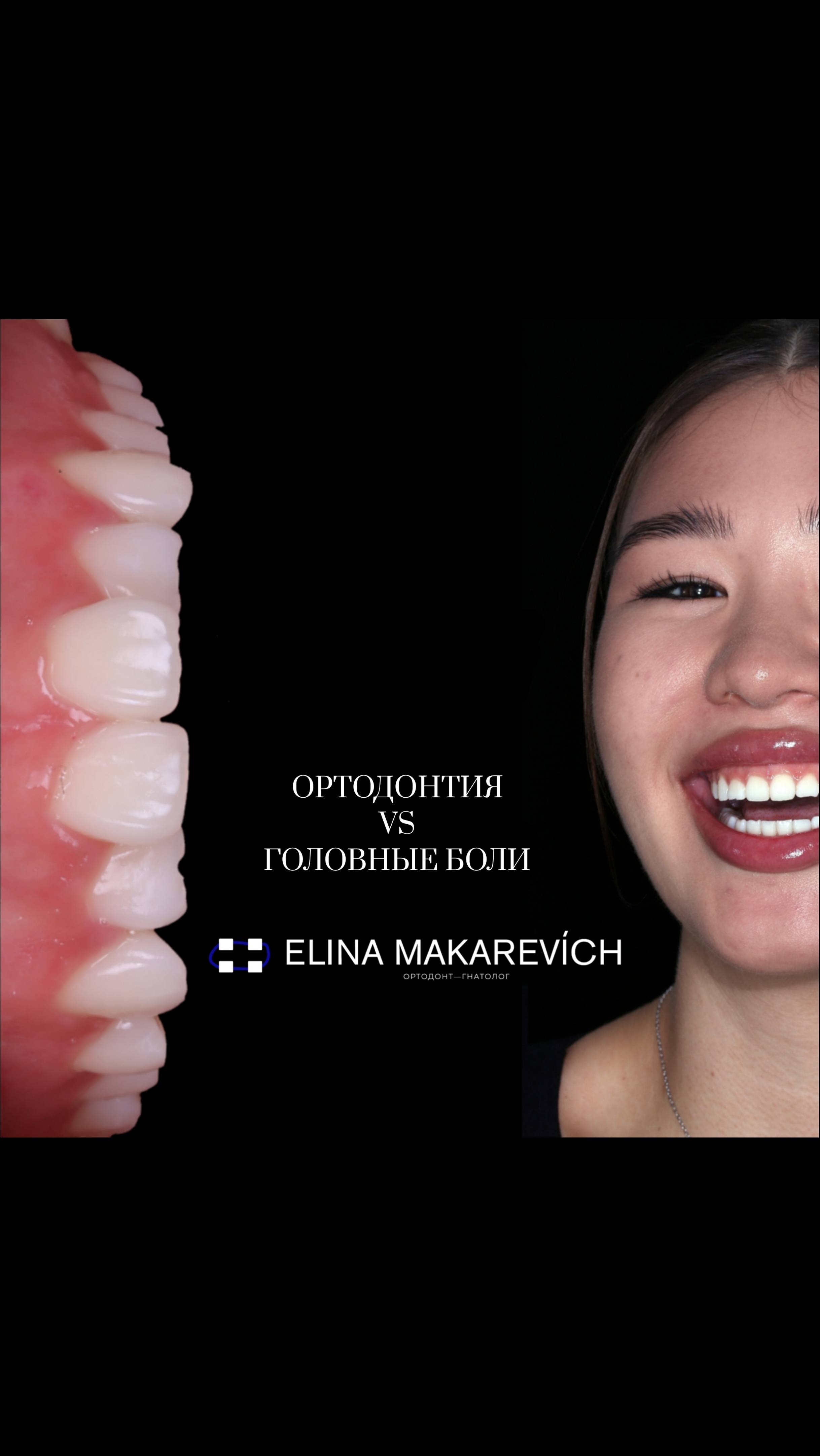 Ортодонтия VS Головные боли