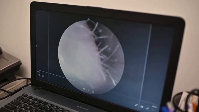 Ендоскопічна хірургія ЛОР органів