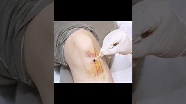 Йод сеткасының пайдасы.Йод. Польза йодовой сетки.