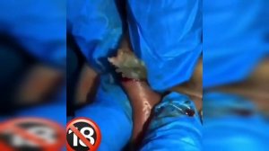 подборка выдавливания прыщей 19 II выдавливание прыщей