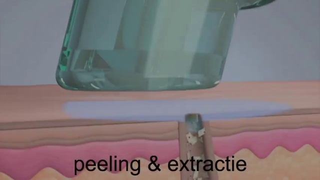 video werking aqua derma hydro dermabrasie смотреть онлайн