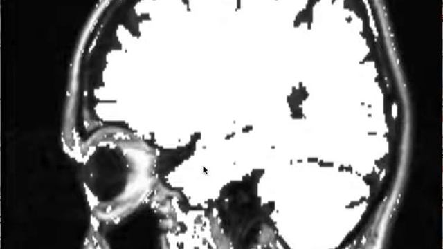 MODIFIED CHAN-VESE METHOD WITH HINTS FROM RANDOM WALK смотреть онлайн