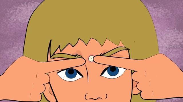 Как избавиться от прыщей (история из жизни, анимация) смотреть онлайн