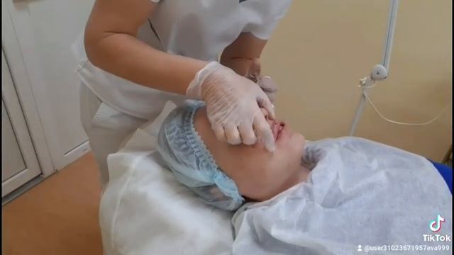 Лицо под ключ:?Лифтинг бровей,коррекция скуловой области,объем губ,коррекция подбородка? смотреть онлайн