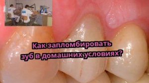 Как запломбировать зуб в домашних условиях?