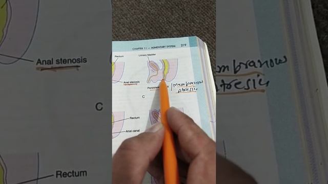 COMPLETE CLINICAL OF HINDGUT |GIT DEVELOPMENT PART9| #mbbs #embryology смотреть онлайн