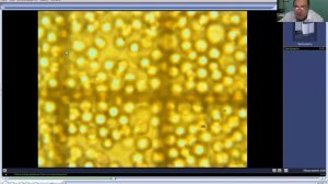 #кровь#под микроскопом