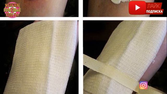 ЛУЧШАЯ МАЗЬ за КОПЕЙКИ, КОТОРАЯ ИЗБАВИТ ОТ МНОЖЕСТВА ПРОБЛЕМ! Левомеколь - свойства!