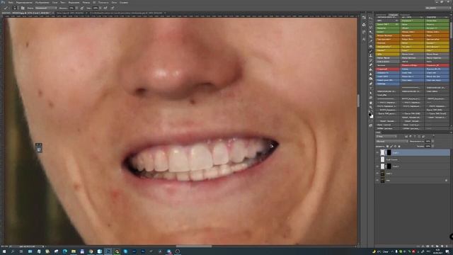 Сложное удаление брекетов в фотошоп. смотреть онлайн