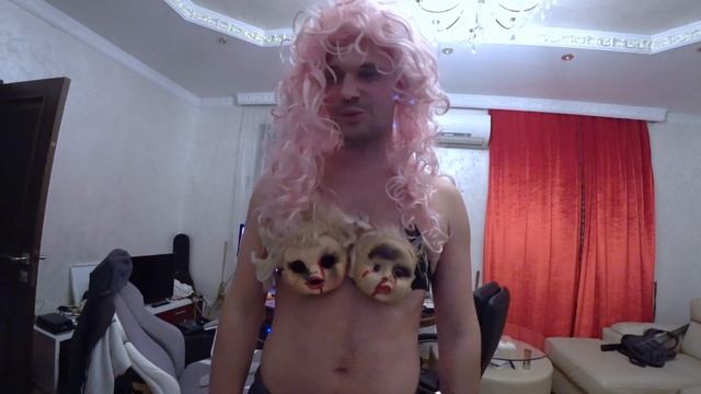 У Кати новый НОС. Сняли гипс после ринопластики