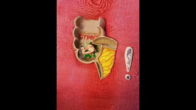 острый аппендицит acute appendicitis смотреть онлайн