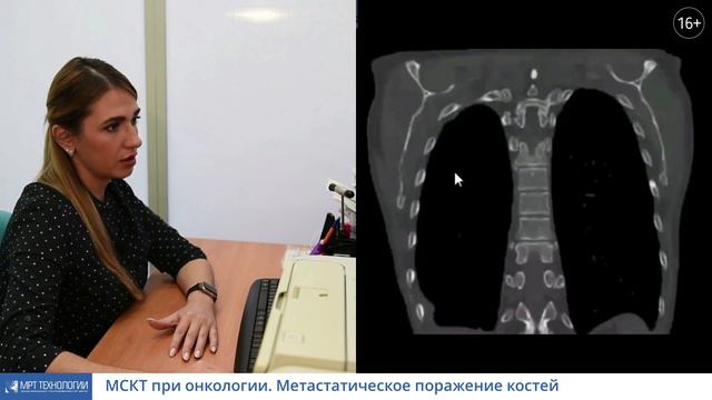 Метастатическое поражение костей смотреть онлайн