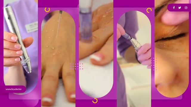 Pressensa Virtual mesotherapy Microneedling COURSE смотреть онлайн