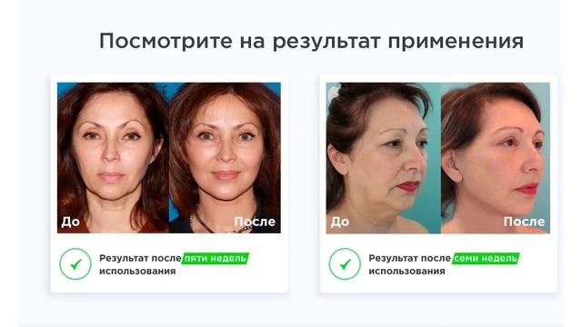 купить маску бандаж для коррекции овала смотреть онлайн