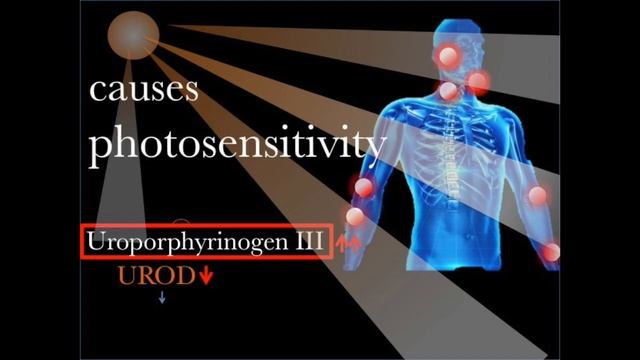 Porphyria Cutanea Tarda, Pathophysiology 【USMLE, Biochemistry】 смотреть онлайн