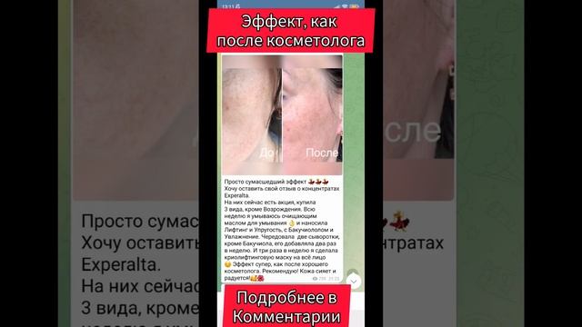 эффект, как после косметолога #уходзакожей #морщины #синяки #мешкиподглазами смотреть онлайн