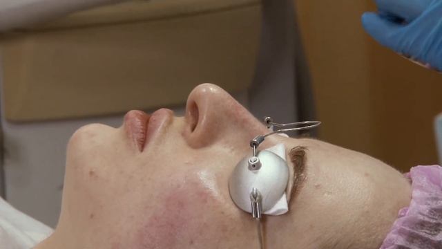 Академия Красоты Лазерный микропилинг смотреть онлайн