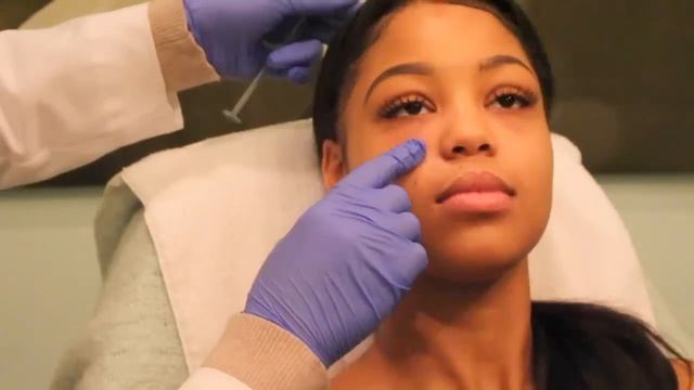 MY EYE FILLER INJECTION EXPERIENCE | LIVE FOOTAGE смотреть онлайн