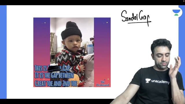 MISSION MAY REVISION | Top 50 SYNDROMES IN PEDIATRICS - 1 | Let's Crack NEET PG | Dr Anand Bhatia смотреть онлайн