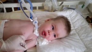 Кормление через желудочный зонд