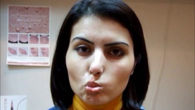 Лала - рабочая сессия 1. Неврит лицевого нерва на фоне шванномы. Восстановление.