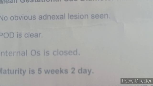 5 weeks ultrasound में 4 चीजें जरूर पता होनी चाहिए /Internal Os is closed हिन्दी में जाने/Read it смотреть онлайн