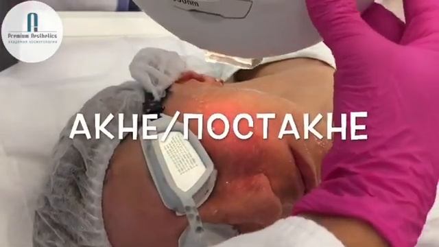 ФОТОЛЕЧЕНИЕ НА АППАРАТЕ М22 (IPL). 09.09.2019 смотреть онлайн