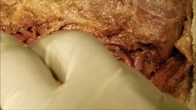 ANGULAR-FACIAL ARTERY VEIN Course Branches and Clinical Correlations – Sanjoy Sanyal смотреть онлайн