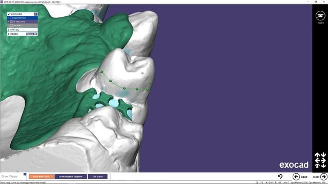 exocad Video Tutorial (basic): Designing a Removable Partial Framework смотреть онлайн
