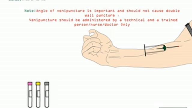 Vacutainer - Sanjay Instruments смотреть онлайн