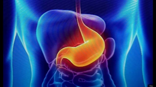 ЛЕЧЕНИЕ ЖЕЛУДКА И ПИЩЕВОДА смотреть онлайн