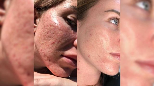 Уход за кожей лица❤️