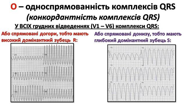 ТАХІКАРДІЯ З ШИРОКИМИ КОМПЛЕКСАМИ на ЕКГ: ШЛУНОЧКОВА ЧИ НАДШЛУНОЧКОВА? ВІДМІННОСТІ, АЛГОРИТМ ДІЙ смотреть онлайн