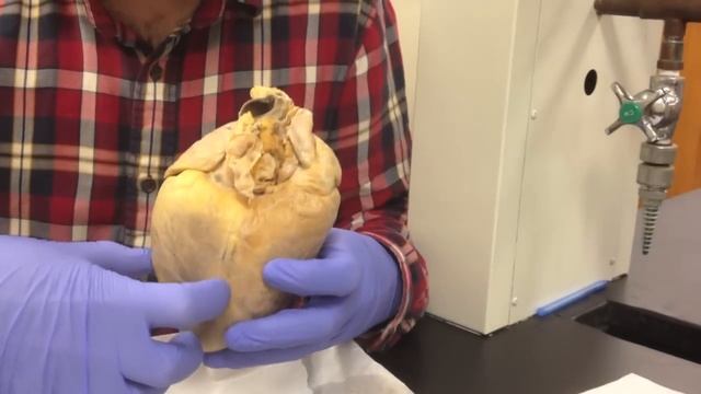 Sheep heart dissection: external structures and blood vessels смотреть онлайн