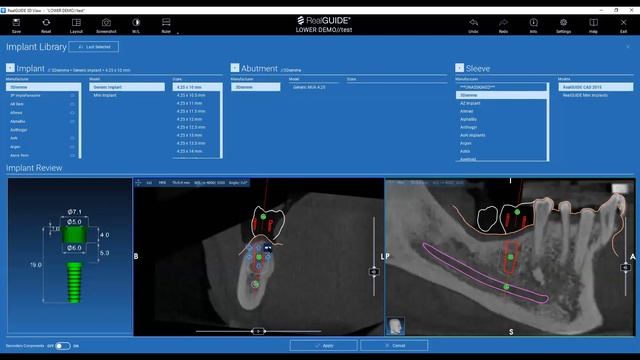 RealGUIDE 5.0 COMPLETE WORKFLOW (ENG) смотреть онлайн