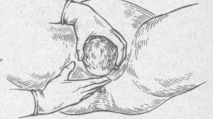 защита промежности