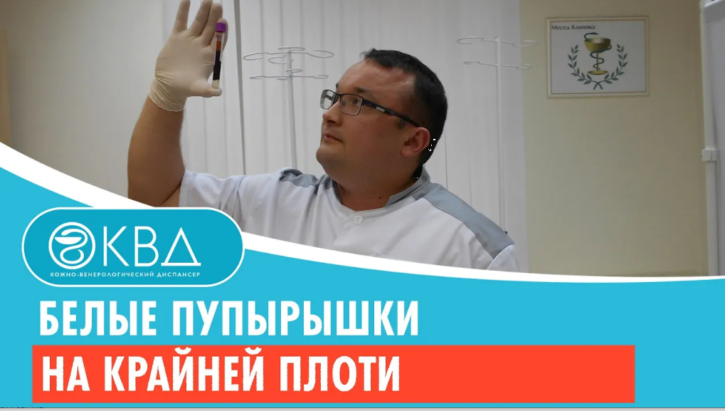 ? Белые пупырышки на крайней плоти. Клинический случай №359 смотреть онлайн