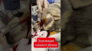 Энуклеация глаза